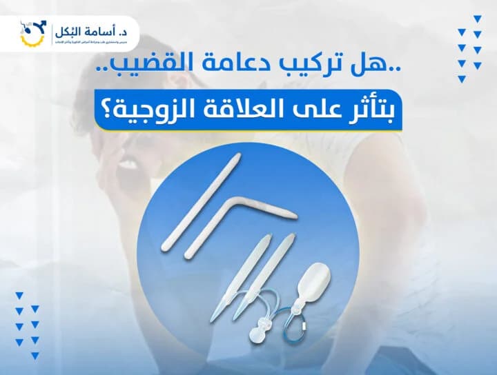 هل تركيب دعامة القضيب بتاثر على العلاقة الزوجية؟
