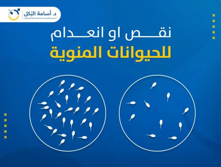 انعدام الحيوانات المنوية