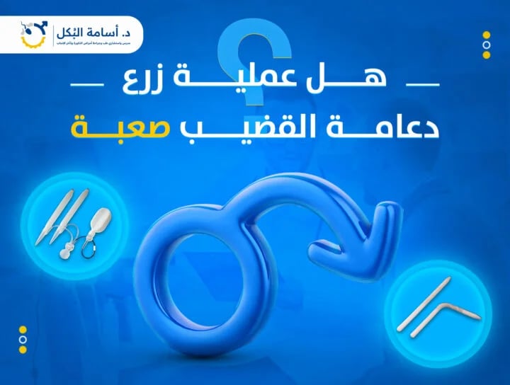 ما هي خطوات عملية تركيب دعامة العضو الذكري؟