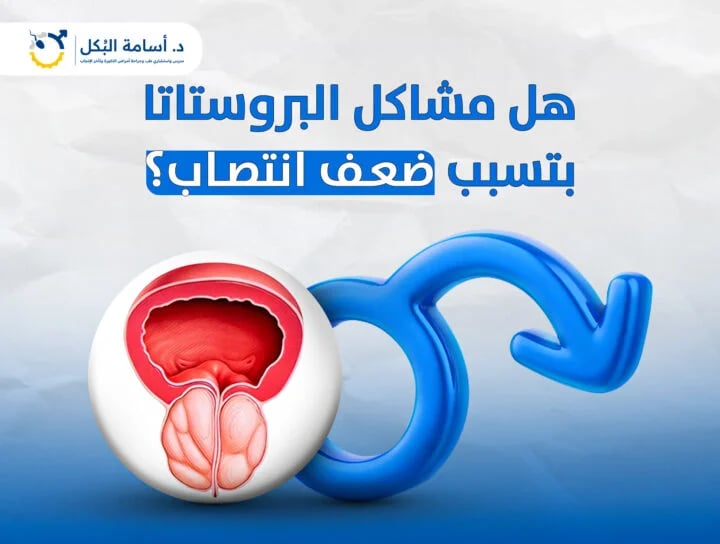هل مشاكل البروستاتا بتسبب ضعف انتصاب ؟