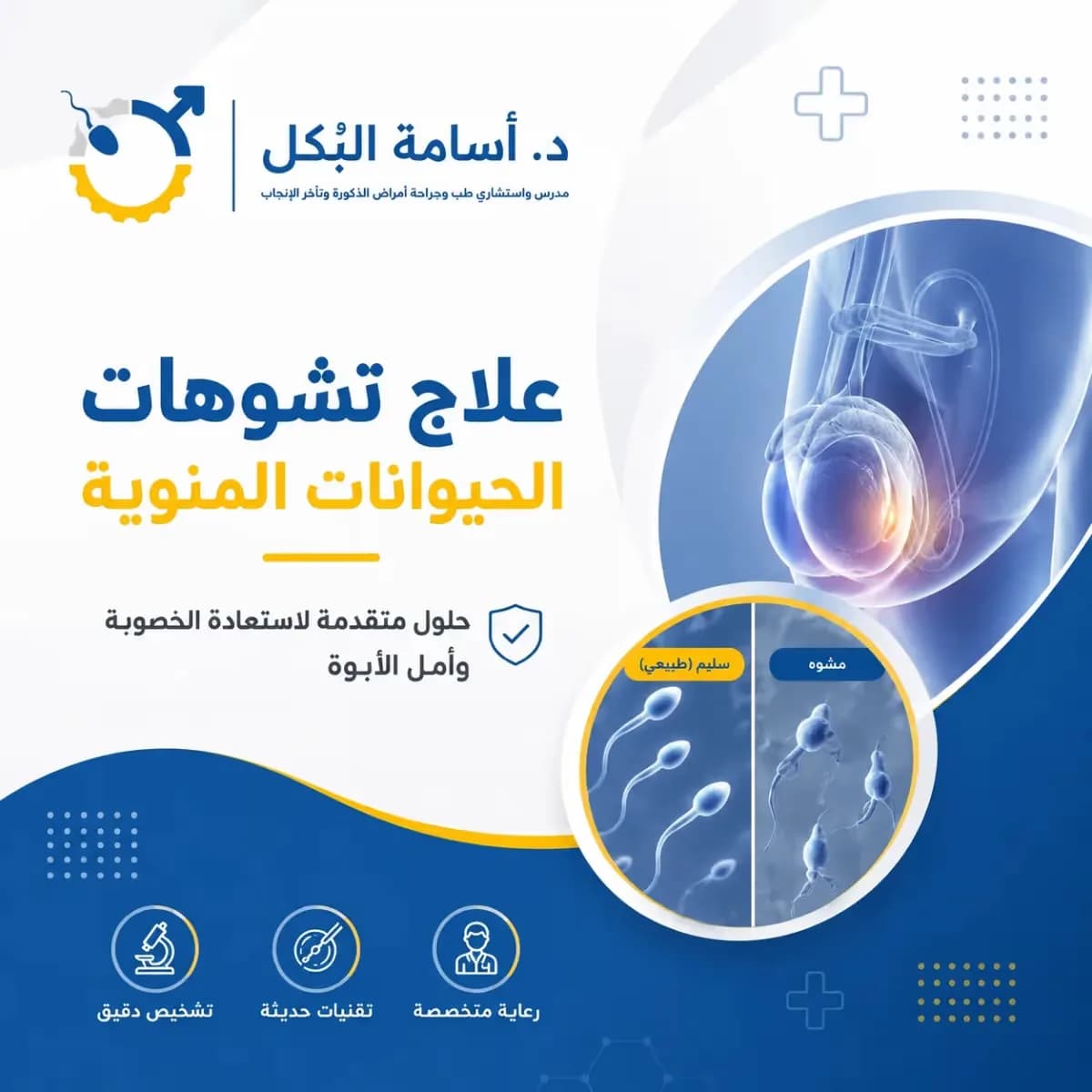 علاج تشوهات لحيوانات المنوية