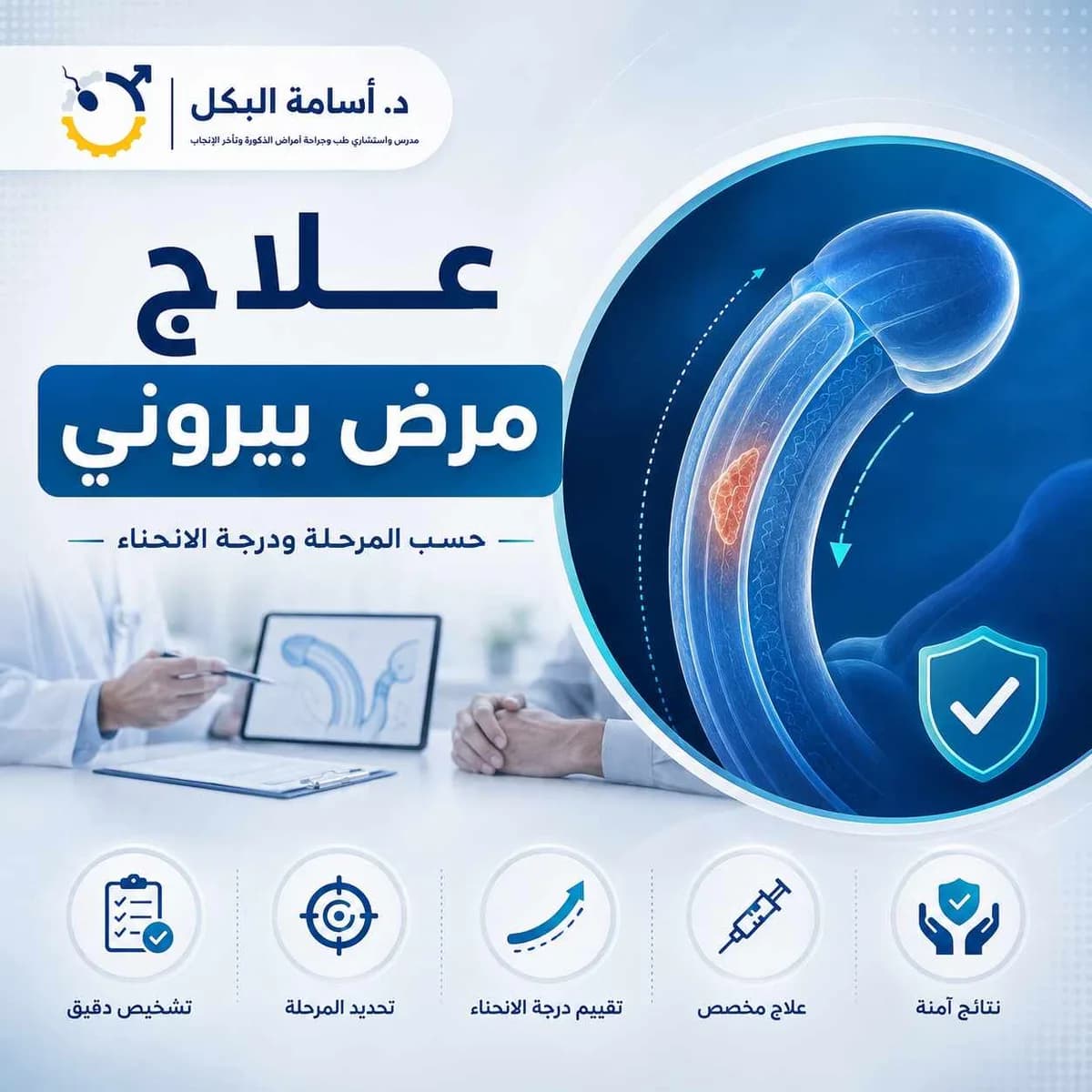 علاج مرض بيروني