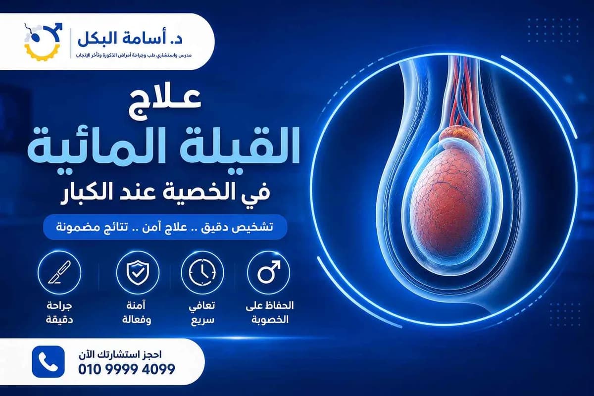 علاج القيلة المائية في الخصية عند الكبار ومتى تحتاج إلى عملية؟