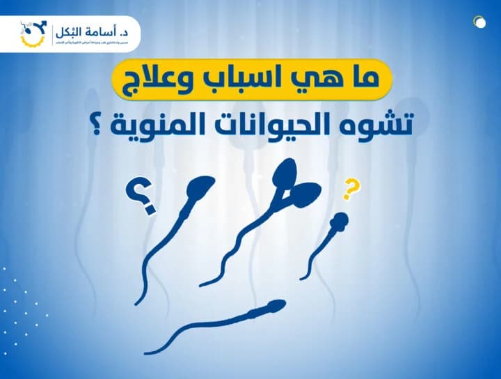 ما هي أسباب وعلاج تشوه الحيوانات المنوية؟