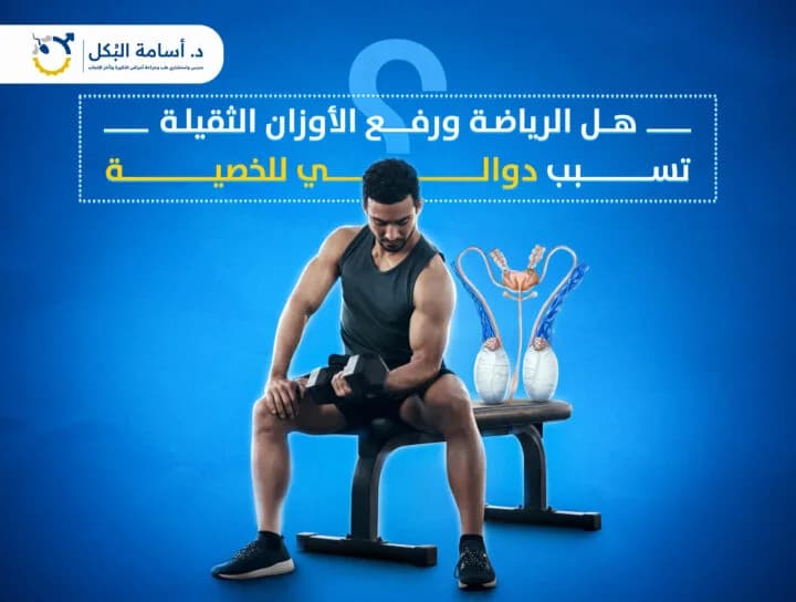 هل الرياضة ورفع الأوزان الثقيلة تسبب دوالي الخصية؟
