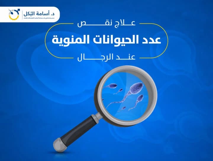 علاج نقص عدد الحيوانات المنوية عند الرجال