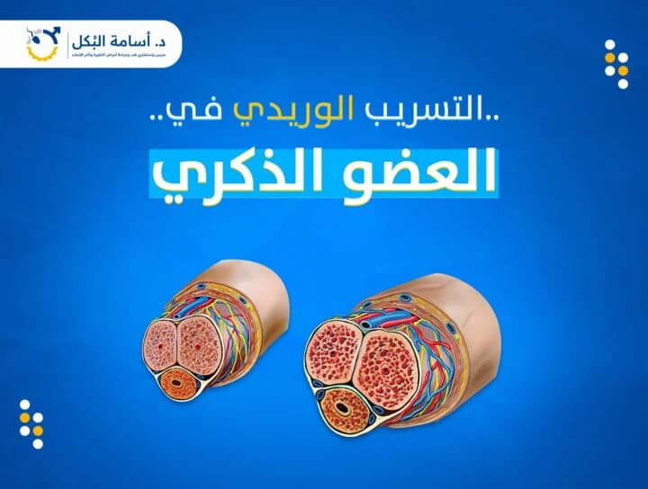 مشاكل الخصية