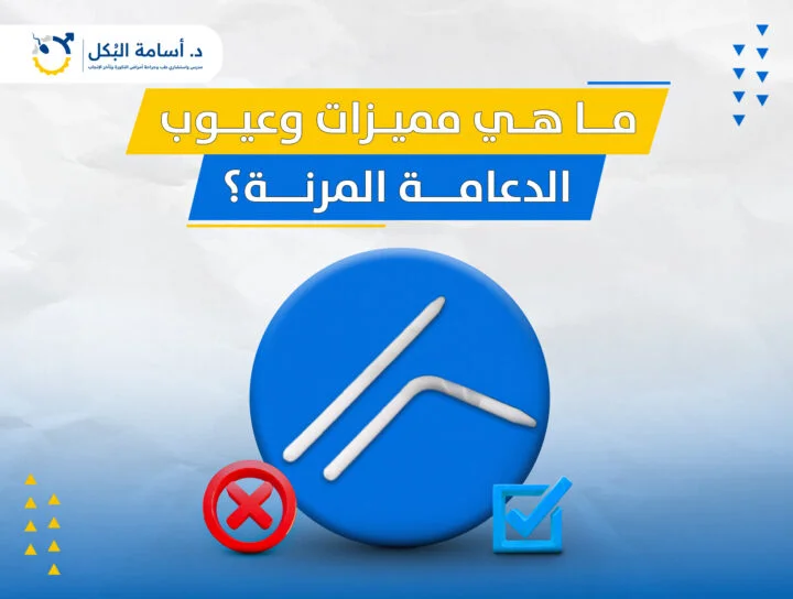 ما هي مميزات وعيوب الدعامة المرنة؟