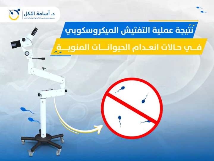 ما هي نتيجة عملية التفتيش الميكروسكوبي في حالات انعدام الحيوانات المنوية ؟