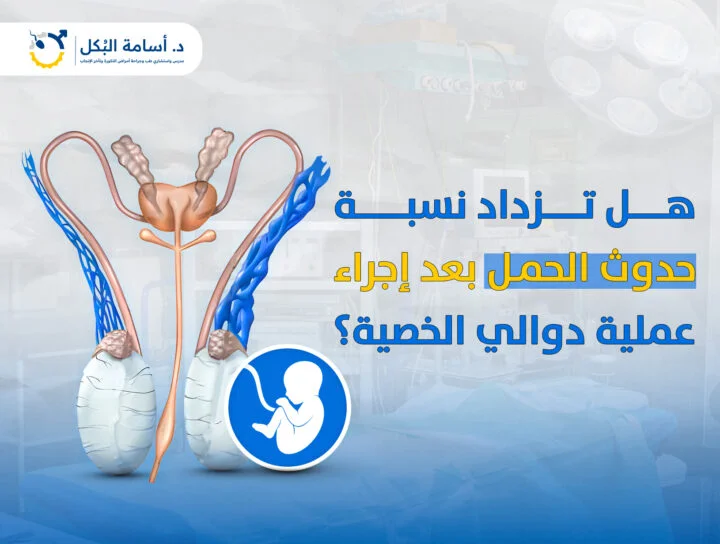 هل تزداد نسبة حدوث الحمل بعد إجراء عملية دوالي الخصية؟