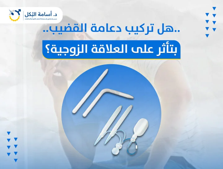 هل تركيب دعامة القضيب بتاثر على العلاقة الزوجية؟