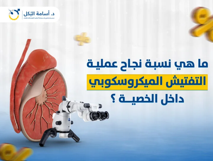 ما هي نسبة نجاح عملية التفتيش الميكروسكوبي داخل الخصية؟