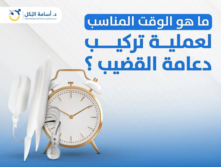 ما هو الوقت المناسب لعملية تركيب دعامة القضيب؟