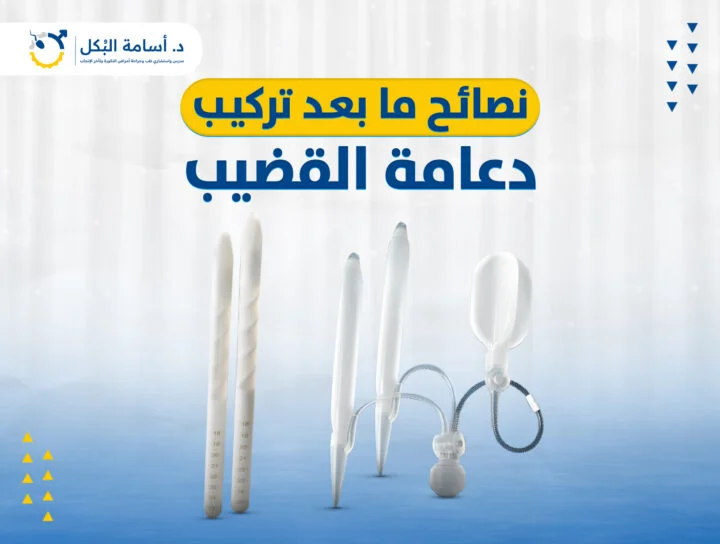 نصائح ما بعد تركيب دعامة القضيب