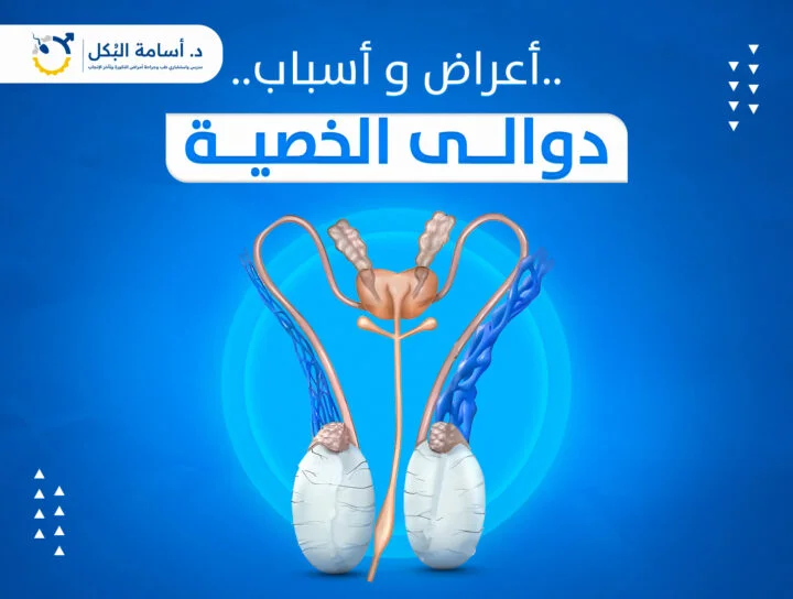 اعراض و اسباب دوالي الخصية