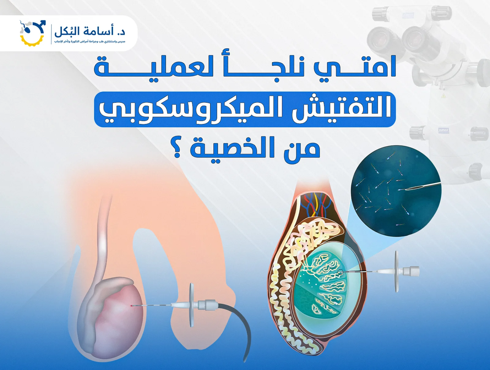 امتي نلجأ لعملية التفتيش الميكروسكوبي من الخصية؟