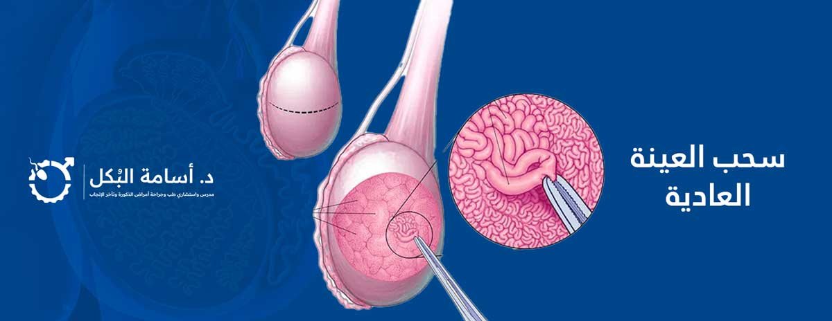 testicular-samples, عينات الخصية العادية