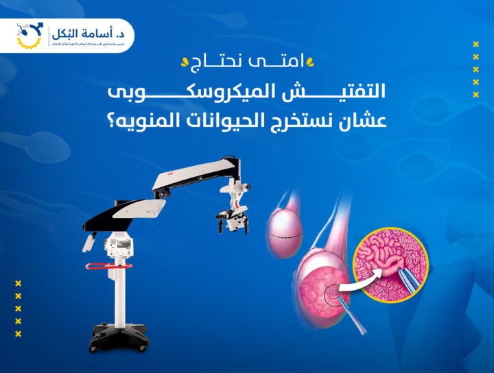 امتى لازم نعمل تفتيش ميكروسكوبى عشان نعالج تأخر الانجاب