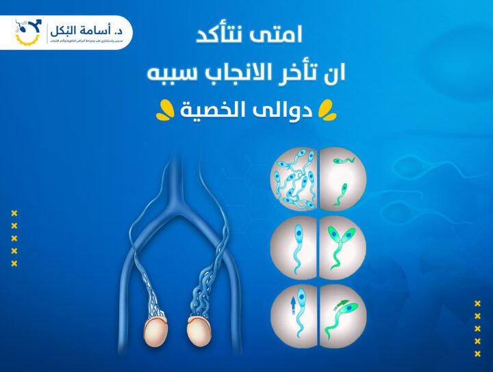 امتى دوالى الخصية تكون السبب فى تأخر الانجاب