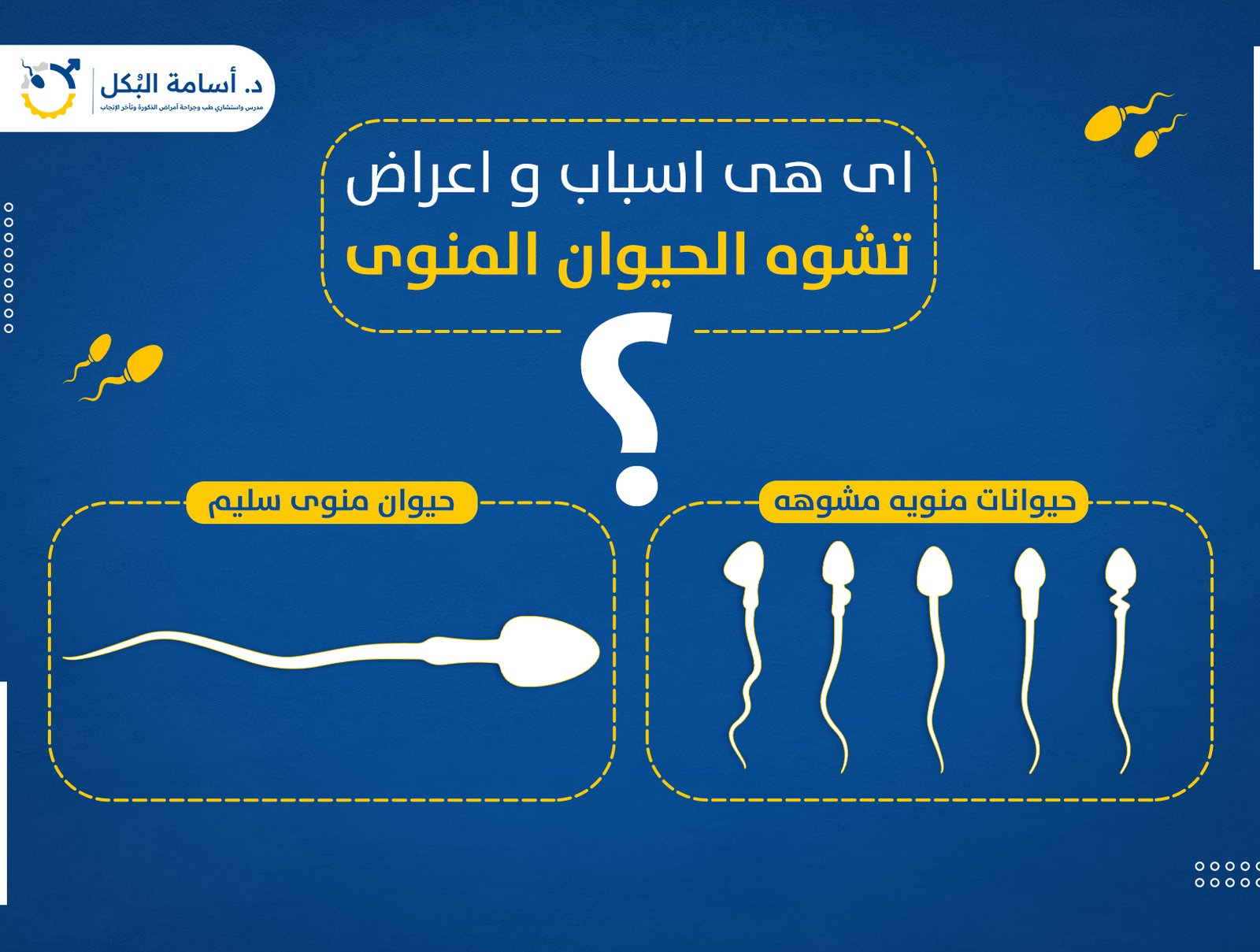 اى هى اسباب و اعراض تشوه الحيوان المنوى ؟