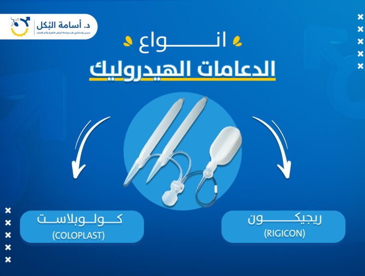 أنواع الدعامات الهيدروليك وإصداراتها