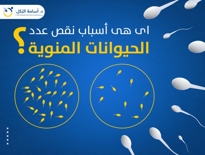 اى هى أسباب نقص عدد الحيوانات المنوية ؟