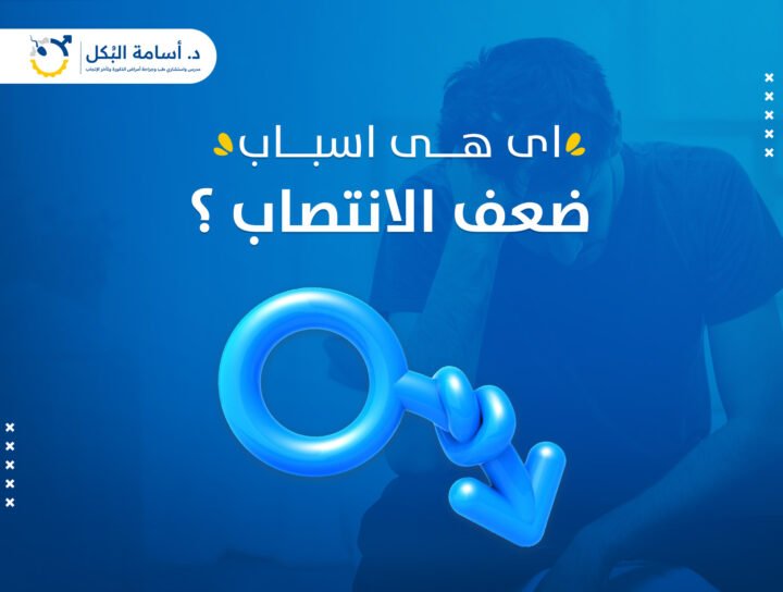 اى هى أسباب ضعف الانتصاب ؟