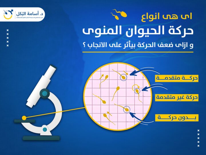 ازاى ضعف حركة الحيوانات المنوية بيأثر على الانجاب ؟