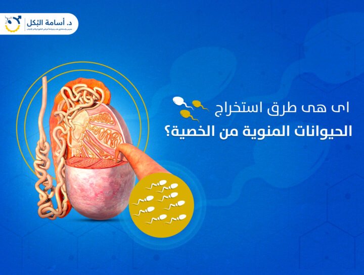 اى هى طرق استخراج الحيوانات المنوية من الخصية ؟