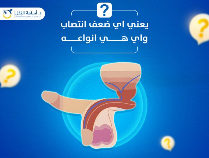 يعنى اى ضعف انتصاب واي هي انواعه ؟