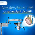 العلاج الهرموني قبل عملية التفتيش الميكروسكوبي